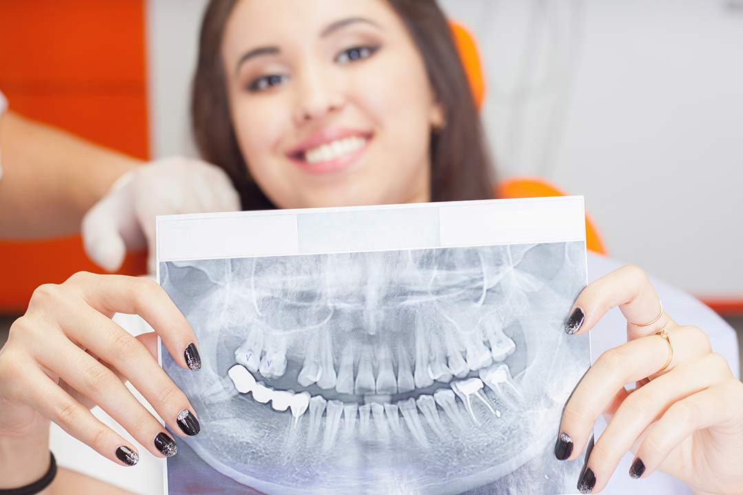 Woman holding dental xray facing camera. The Xray shows dental implants are healing.